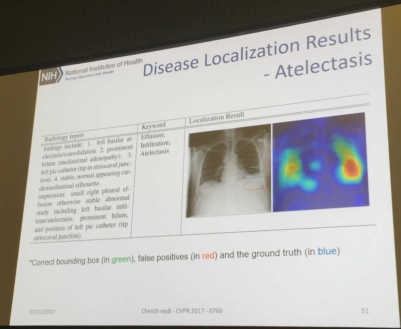 The Power of Artificial Intelligence (AI), Virtual and Augmented Reality (VR and AR) on Medical Imaging at GPU Tech Conference (GTC) 2017