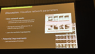 The Power of Artificial Intelligence (AI), Virtual and Augmented Reality (VR and AR) on Medical Imaging at GPU Tech Conference (GTC) 2017