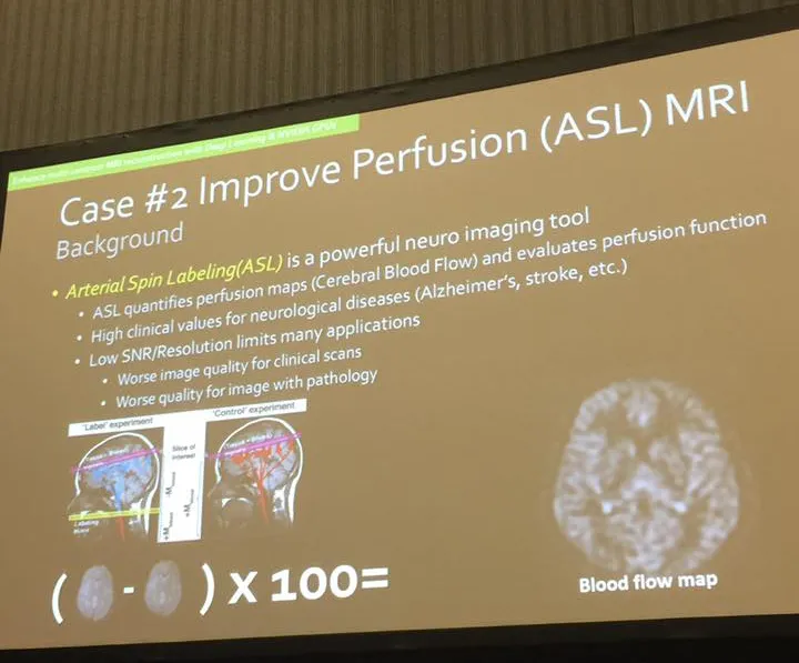 The Power of Artificial Intelligence (AI), Virtual and Augmented Reality (VR and AR) on Medical Imaging at GPU Tech Conference (GTC) 2017